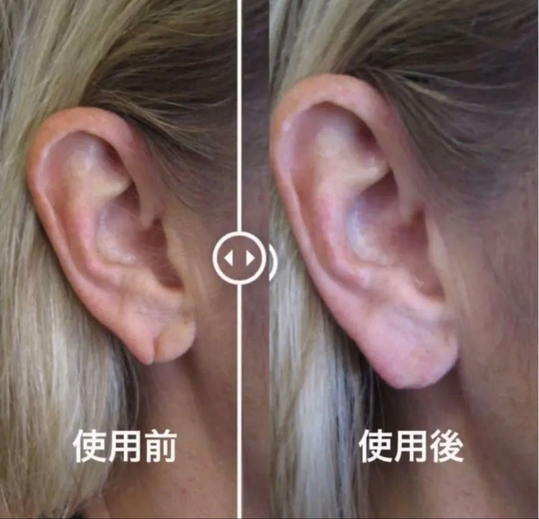 【予約専用ページ購入不可】 dermaflage